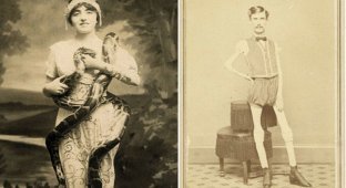 Суровый XIX век: коллекция архивных фотографий людей с деформациями (32 фото)
