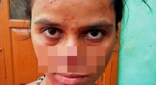 Обидевшись из-за приданного, индиец отрезал жене нос и сбежал с ним (4 фото)