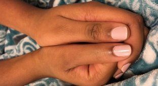Девушка-мутант: американская школьница живет с несгибаемыми пальцами (5 фото)