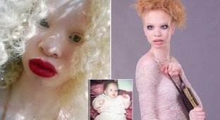 Красавица-альбинос добилась успеха в модельном бизнесе (11 фото)