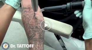 Исправление ошибок молодости  как лазером удаляют татуировки