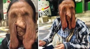 Женщина с растаявшим лицом отказалась от хирургической операции (6 фото + 1 видео)
