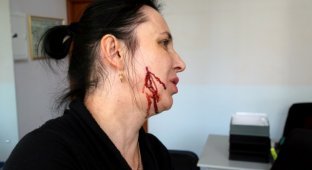 История клиентки банка, которую кассирша ударила в лицо шариковой ручкой (2 фото + видео)