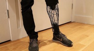 Каркасный протез из титана, распечатанный на 3D-принтере, может совершить революцию в цене протезов (7 фото)