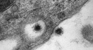Как выглядит дельта-штамм коронавируса (2 фото)