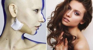 Невероятные фотографии модели, потерявшей челюсть из-за рака (19 фото)