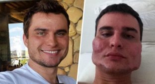 В Бразилии судят хирурга Уэсли Мураками, который изуродовал лица как минимум 40 пациентов (3 фото)