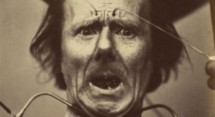 Наука, ты меня пугаешь: как невропатолог Дюшен де Булонь изучал эмоции и мышцы лица в 1862 году (22 фото)