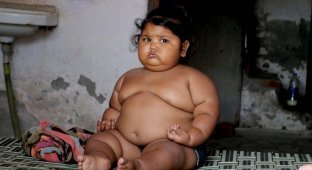 Из-за генной мутации девочку разнесло до невероятных размеров: 25 кг в возрасте 1,4 года (6 фото)