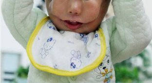 Китайский мальчик с врожденной маской на лице (5 фото)