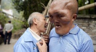 В Китае живет человек с "лицом инопланетянина" (6 фото)