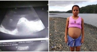 Жители Филиппинской провинции Албай верят, что 17-летняя девушка беременна рыбой (3 фото)