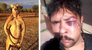 В Австралии кенгуру сломал челюсть 19-летнему охотнику (5 фото)