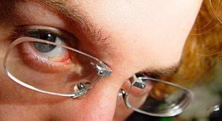 Очки-имплантанты (6 фото)