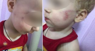 Воспитатель избила и заперла малыша в туалете из-за плача (3 фото)