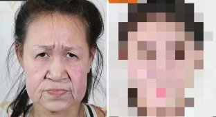 15-летнюю китаянку путали с бабушкой, но после операции она стала красавицей (8 фото)