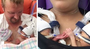 Недоношенные близнецы, держащиеся за руки, покорили интернет (6 фото + 1 видео)