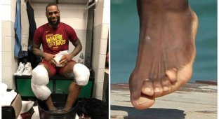 Баскетбол требует жертв: "лотусовые ножки" игроков НБА (10 фото)