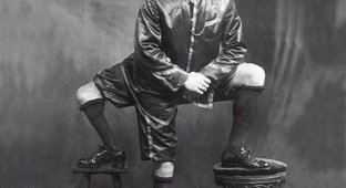 Франческо Лентини - человек с тремя ногами (5 фото)