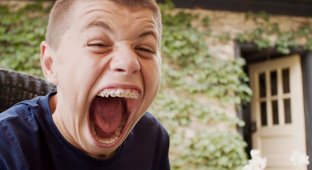 Подросток с самым большим ртом попал в книгу рекордов Гиннеса (5 фото + 1 видео)