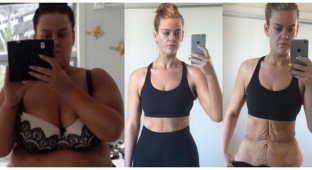 25-летняя девушка, похудевшая на 92 кг, показала результаты борьбы с обвисшей кожей (16 фото)