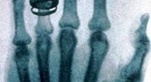 5 одних из самых интересных рентгеновских снимков за всю историю (7 фото)