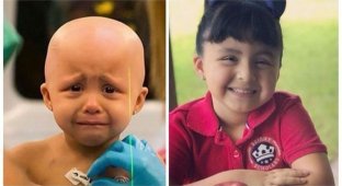 Люди, которые боролись с раком и победили: снимки "до" и "после" (13 фото)