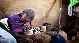 Деревня прокаженных в Эфиопии (21 фото)
