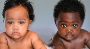 Двойняшки с разным цветом кожи (10 фото)