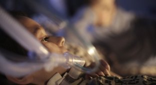 В оставшемся без света Севастополе родители борются за жизнь мальчика, подключенного к аппарату искусственного дыхания (4 фото)