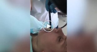 Видео из операционной изо рта россиянки медики извлекли огромную змею