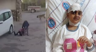 Отважная мать спасла ребенка, разжав челюсти питбулю (2 фото)