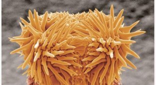 Как выглядят самые распространенные вредные микроорганизмы (12 фото)