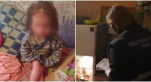 Собутыльник отца заметил в комнате тощую малышку с обмороженными ногами (2 фото + 1 видео)