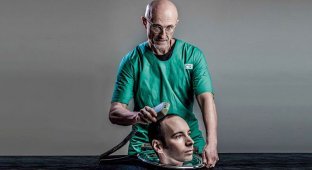 Эксперимент по пересадке головы человеку (11 фото)
