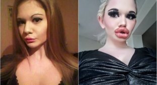Девушка из Болгарии с самыми большими в мире губами провела 20-ю процедуру по их увеличению (12 фото)