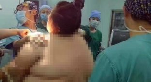 Чтобы принять роды у тучной женщины понадобилось 16 медицинских работников (6 фото)