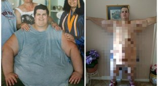 Мужчина весом более 320 кг сумел похудеть. Но повисла огромная проблема! (12 фото + 1 видео)