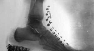 Мир на рентгеновском снимке (15 фото)