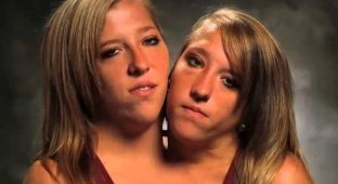 15 интересных фактов о сиамских близняшках Хенсел (16 фото)