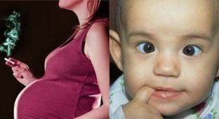 Ученые выяснили, что курящие женщины чаще рожают детей с косоглазием (2 фото)