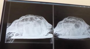 Врачи извлекли мертвую черепаху из молодой британки (2 фото)