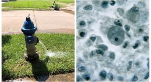 В техасском водопроводе обнаружили амебу, пожирающую мозг (5 фото)