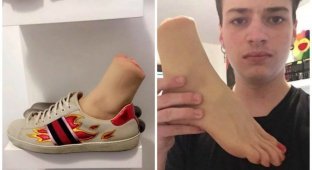 Мужчине прислали вместо обуви вагину в ноге (5 фото)