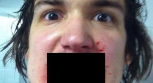 Прямое попадание хоккейной шайбы в лицо (2 фото) (жесть)