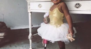 Аврора Каиро — очаровательная 2-летняя малышка с протезом ноги (6 фото)