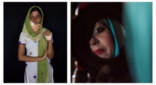 Жуткая фотовыставка: женщины, на которых напали и облили кислотой (11 фото)