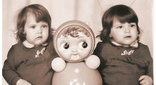 Как живут сейчас первые удачно разделенные в СССР сиамские близнецы (10 фото)