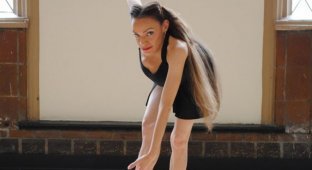 Профессиональная танцовщица с серьезными пороками развития костей (7 фото)