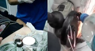 В Запорожье обиженная жена надела гайку на пенис мужа, отомстив ему за измену (4 фото + 1 видео)